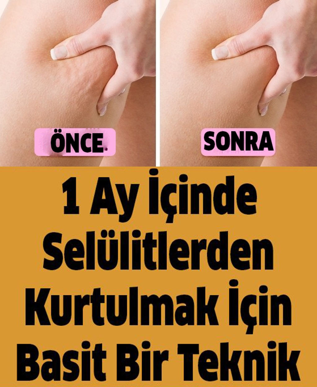 1 Ay İçinde Selülitlerden Kurtulmak İçin Basit Bir Teknik - 1