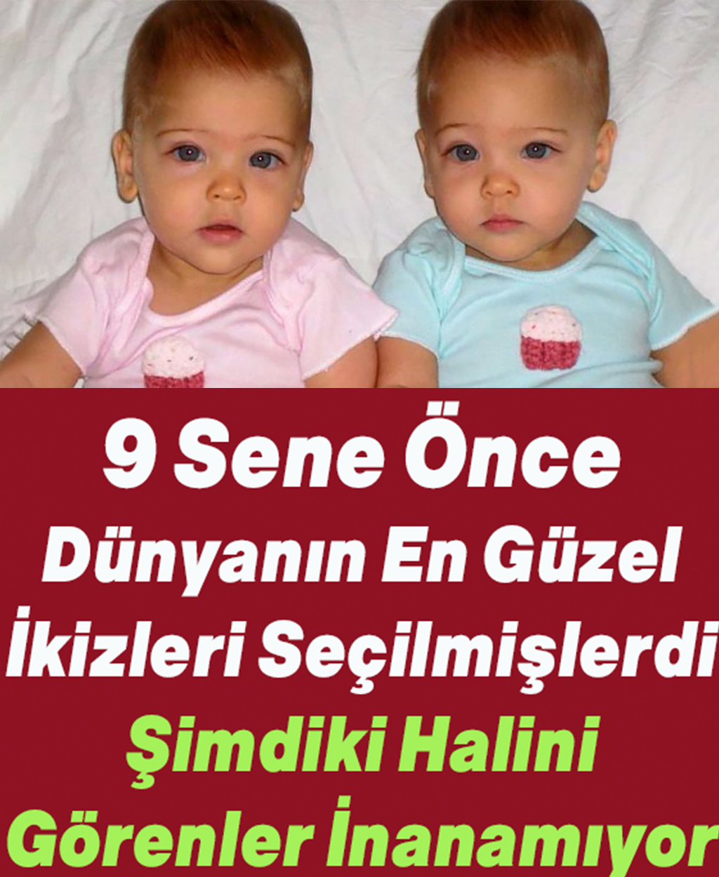 9 Sene Önce Dünyanın En Güzel İkizleri Seçilmişlerdi Şimdiki Halini Görenler İnanamıyor - 1
