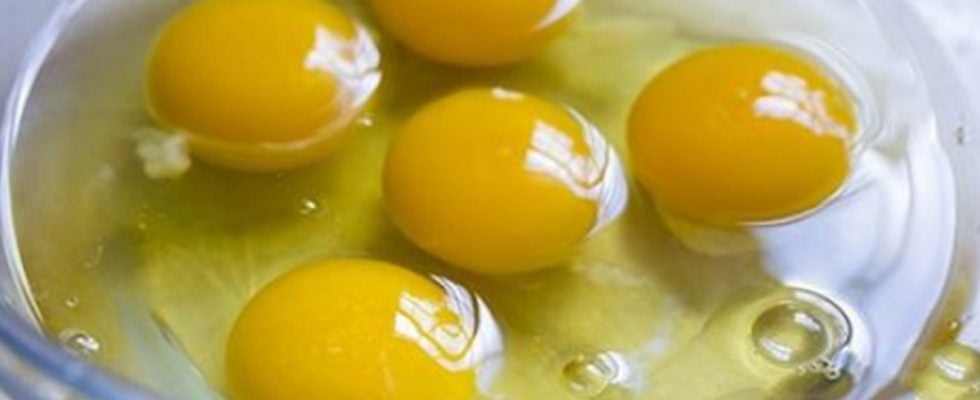 Alzheimer Hastası Olmamak İçin 9 Alışkanlığı Hemen Terkedin - 1