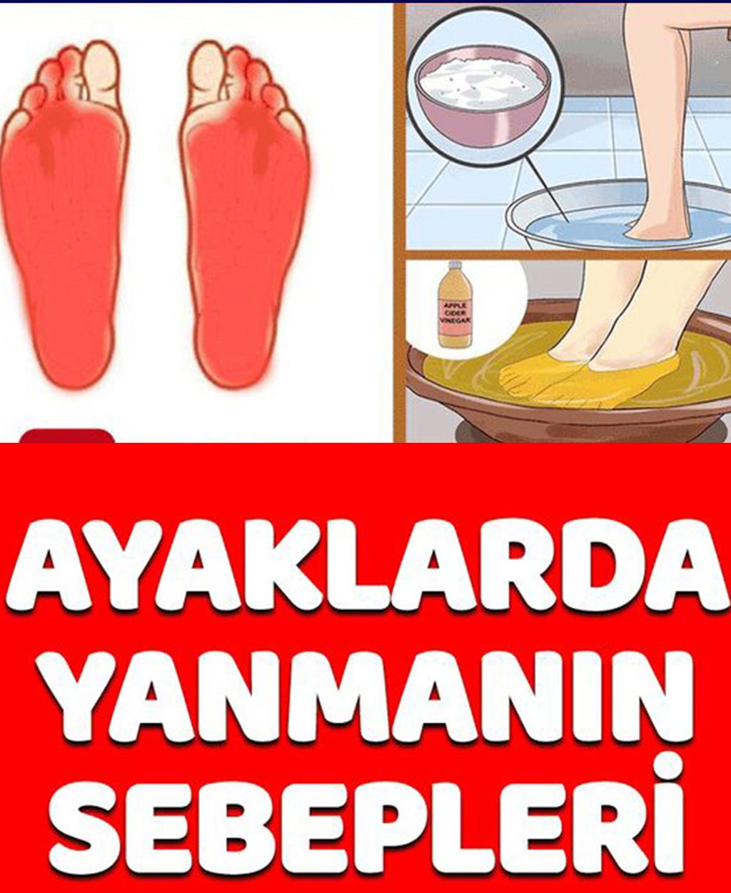 Ayaklarda Yanma Sebepleri - 1