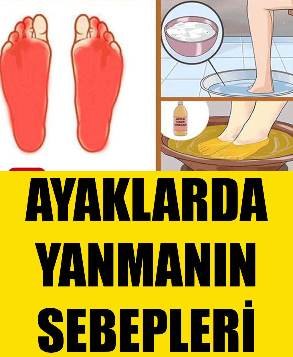 Ayaklarda Yanma Sebepleri - 1