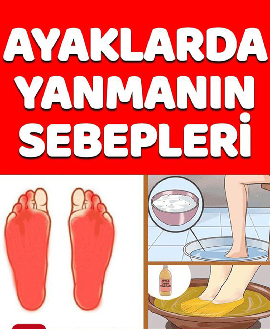 Ayaklarda Yanma Sebepleri - 1