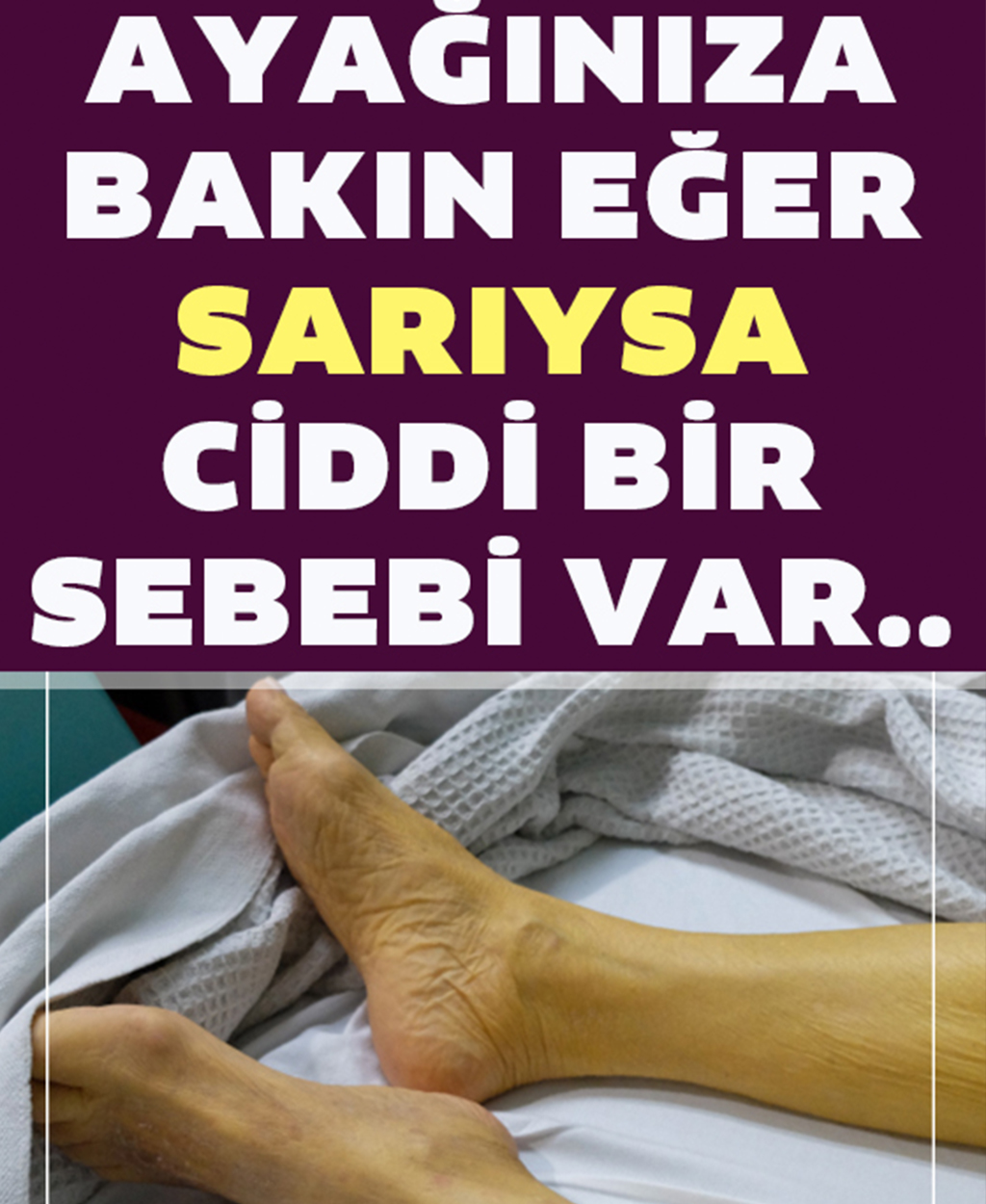 Ayak sararması neden olur - 1