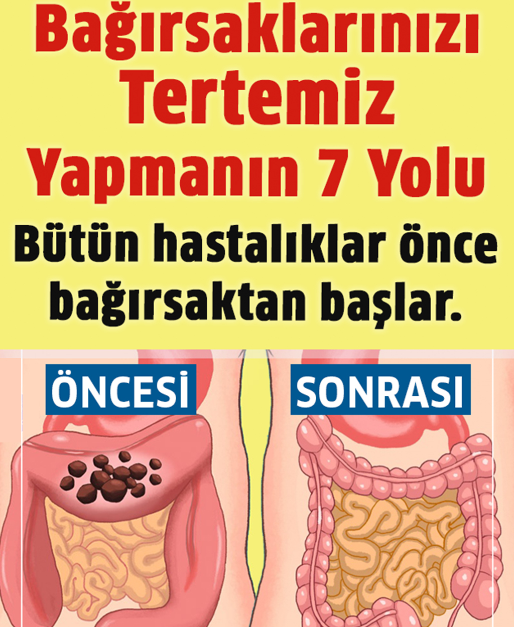 Bağırsakları Tertemiz Yapmanın Yedi Yolu - 1