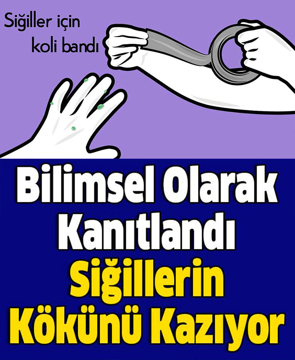 Bilimsel Olarak Kanıtlandı Siğillerin Kökünü Kazıyor - 1