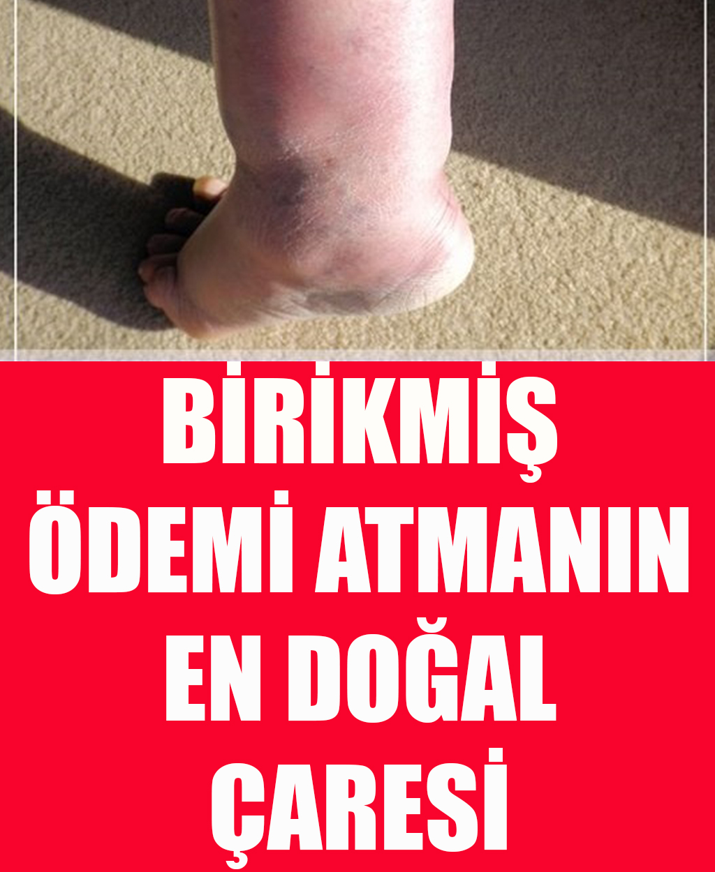 Birikmiş Ödemi Atmanın En Doğal Çaresi - 1
