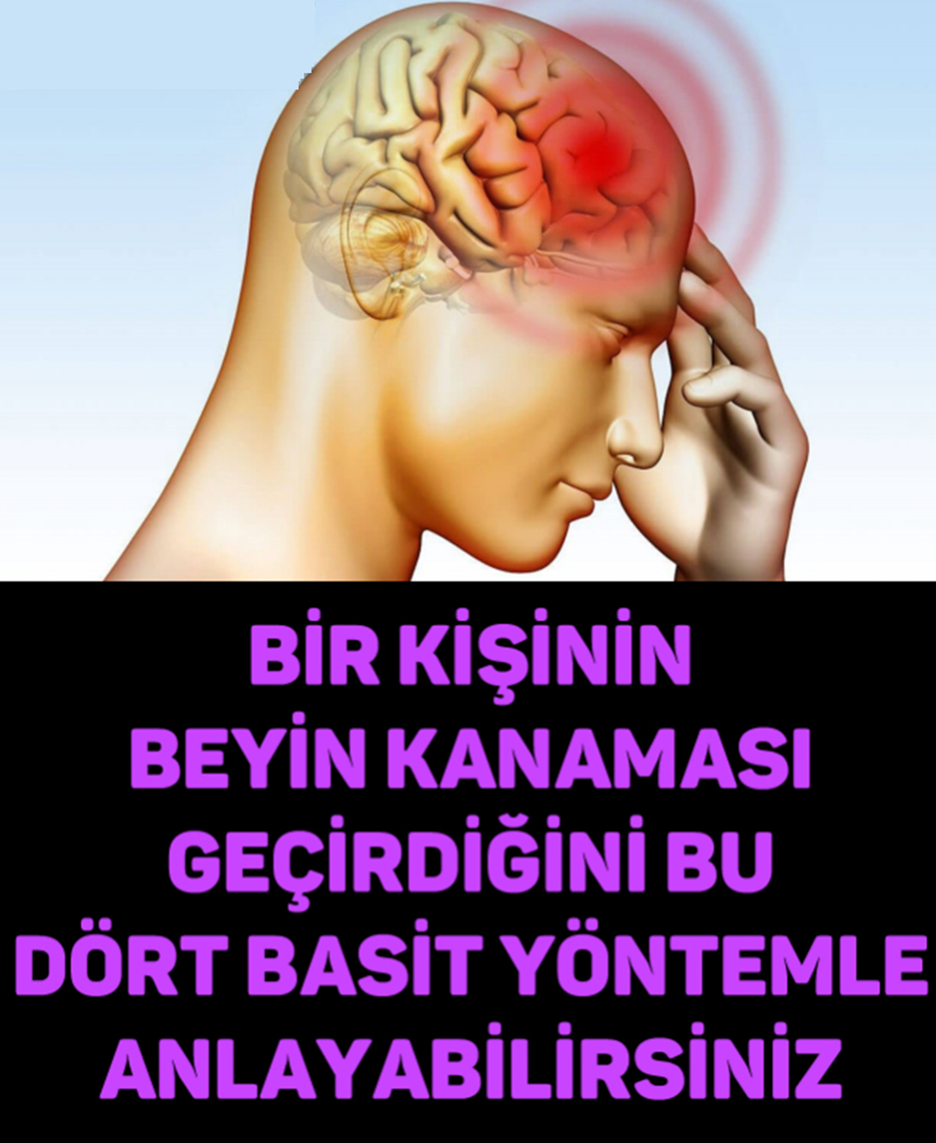 BİR KİŞİNİN BEYİN KANAMASI GEÇİRDİĞİNİ BU DÖRT BASİT YÖNTEMLE ANLAYABİLİRSİNİZ - 1
