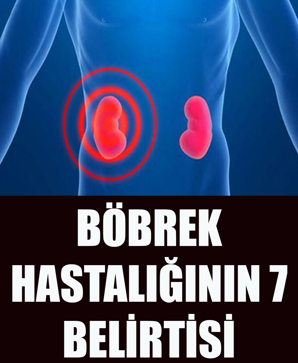 Böbrek Hastalığının 7 Belirtisi - 1