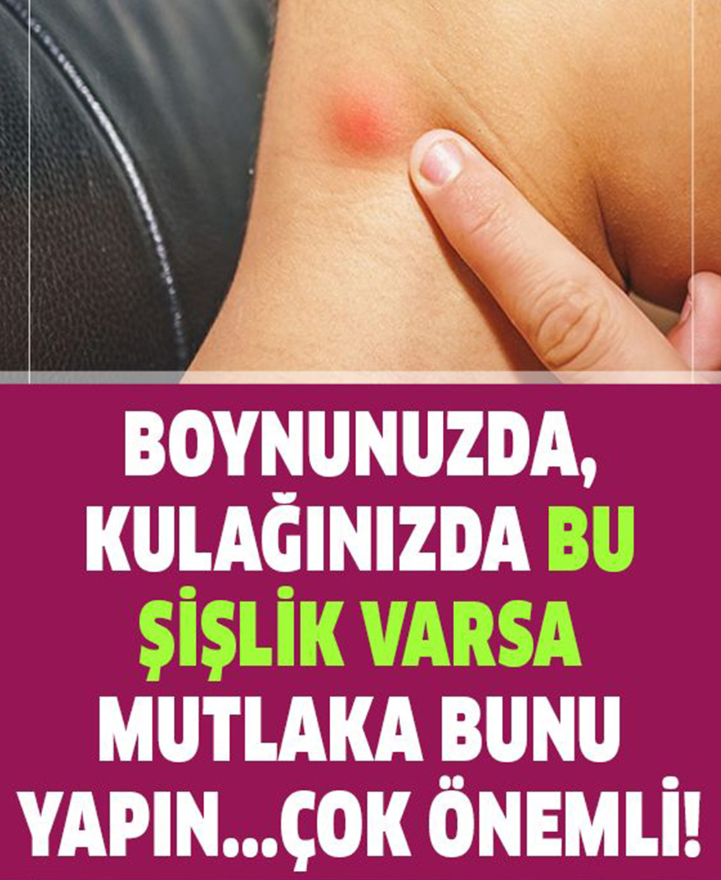 Boyunda ve kulağınızda şişlik varsa mutlaka kontrol edin - 1