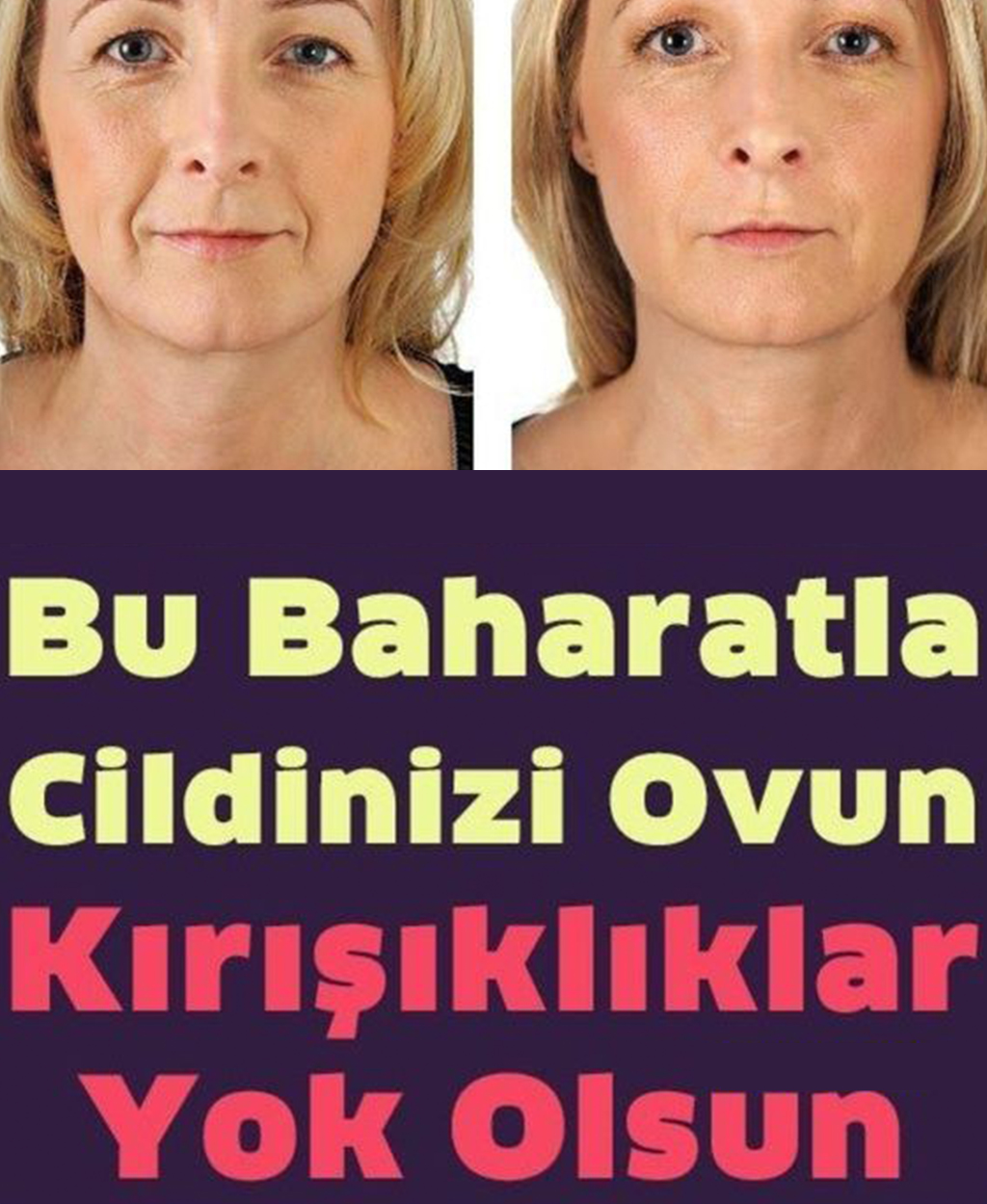 Bu Baharatla Cildinizi Ovun ve Kırışıklıklar Yok Olsun	 - 1