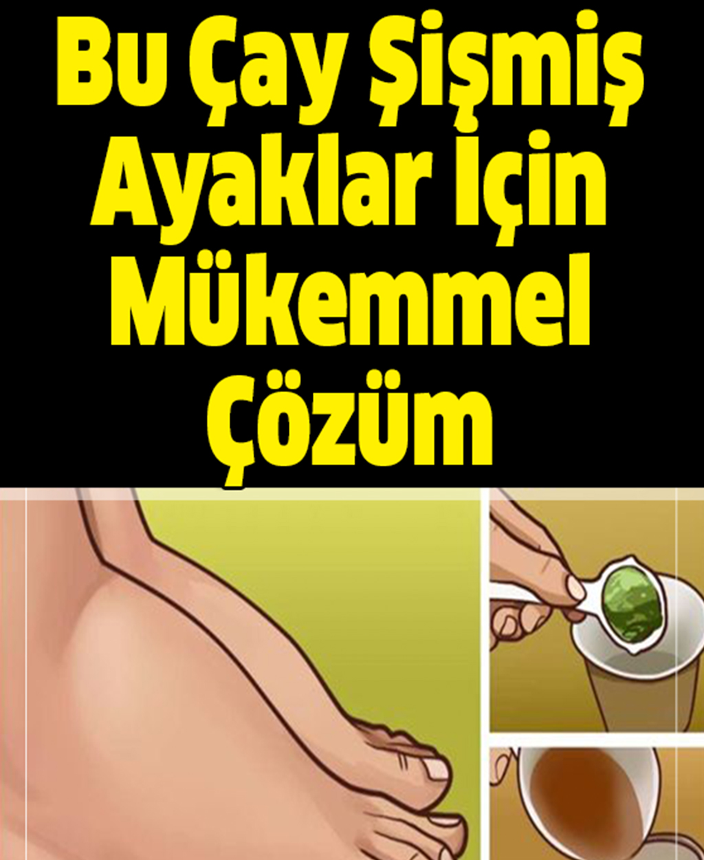Bu Çay Şişmiş Ayaklar İçin Mükemmel Çözüm - 1