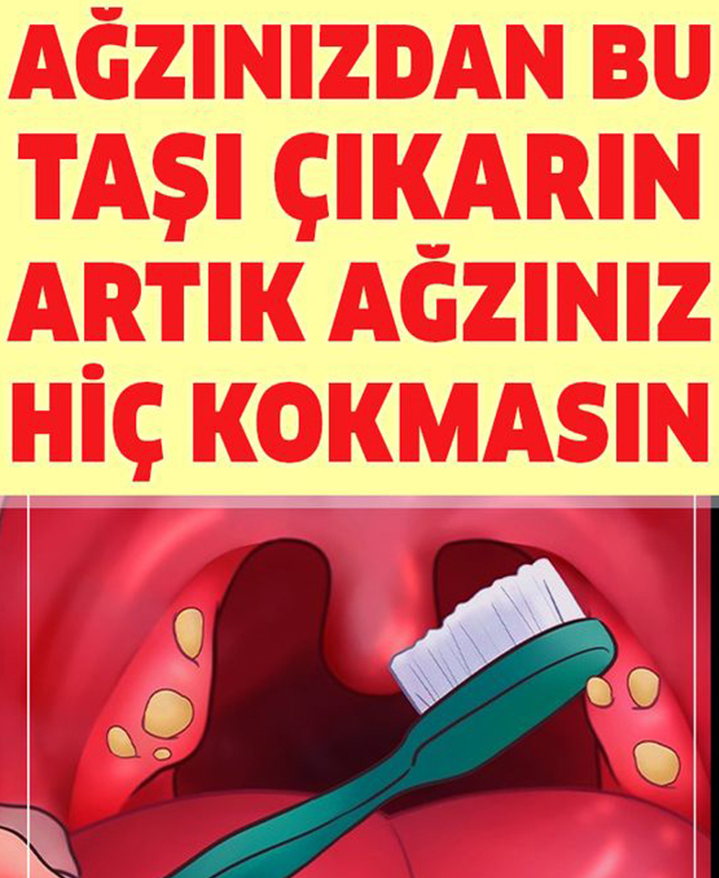 Bademcik taşı problemlerine bu 6 yöntemle son verin - 1