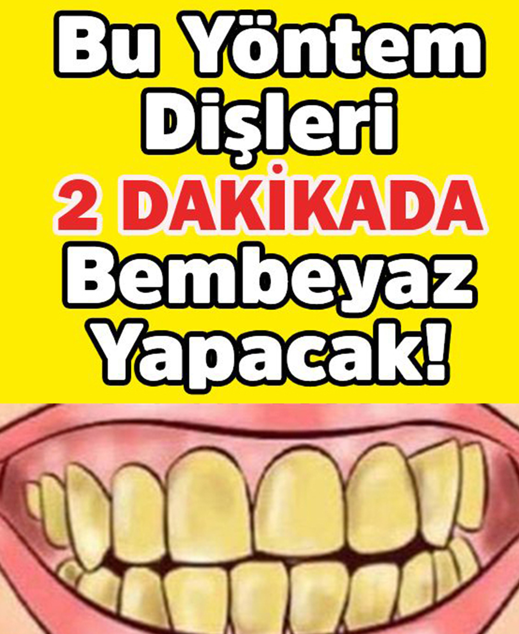 Bu Formülle 2 Dakikada Dişleriniz Bembeyaz - 1