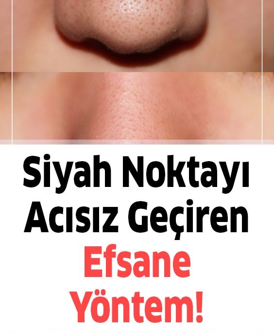 Siyah Nokta ve Yaşlılık Kirlerini Yok Edin - 1