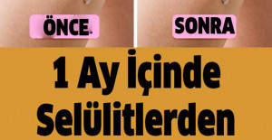 1 Ay İçinde Selülitlerden Kurtulmak İçin Basit Bir Teknik