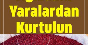 Ağızdaki Yaraları 1 Saat İçinde Yok Ediyor