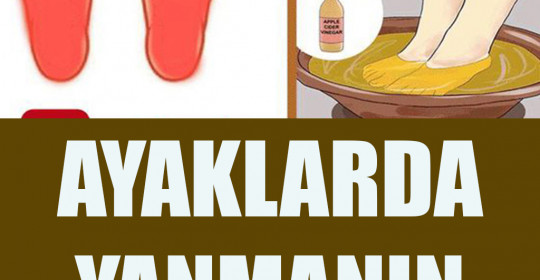 Ayaklarda Yanma Nedenleri