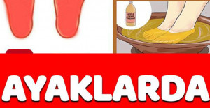 Ayaklarda Yanma Sebepleri