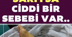 Ayak sararması neden olur