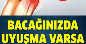 Bacağınızdaki Uyuşmayı Sakın Hafife Almayın Neyin Belirtisi