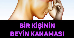 BİR KİŞİNİN BEYİN KANAMASI GEÇİRDİĞİNİ BU DÖRT BASİT YÖNTEMLE ANLAYABİLİRSİNİZ