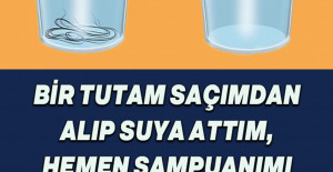 Saçın Ne Durumda Olduğunu Gösteren Saç Testi