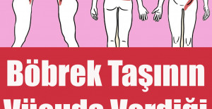 Böbrek Taşının Vücuda Verdiği 5 Belirti	