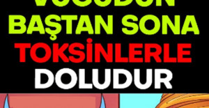 Eğer Bu Belirtiler Varsa Vücudunuz Baştan Aşağı Toksinle Doludur