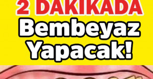 Bu Formülle 2 Dakikada Dişleriniz Bembeyaz