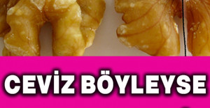 Ceviz Böyle İse Sakın Yemeyin