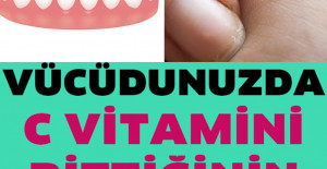 Vücudunuzun C Vitamini Bitmiş Olduğunun 10 Erken Belirtisi