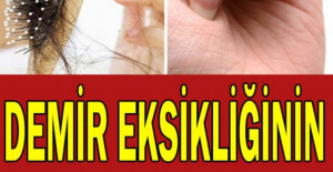 Demir Eksikliğinin 12 Önemli Belirtisi
