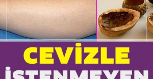 Cevizle İstenmeyen Tüylerden Kurtulmanın Kesin Yolu