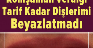 Hiç Bir Şey Komşumun Verdiği Tarif Kadar Dişlerimi Beyazlatmadı