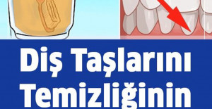 Diş Taşlarının Temizliğinin En Kolay 3 Yolu