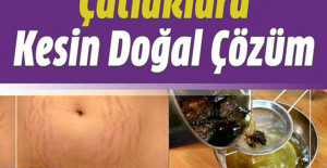 Doğum Çatlakları Nasıl Geçer? Ne İyi Gelir?