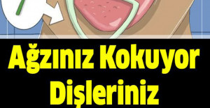 Ağzınız Kokuyor Dişleriniz Çürüyorsa İşte Çözümü