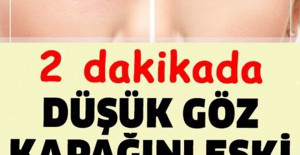 Düşük Göz Kapağını Eski Haline Getirmenin Püf Noktası