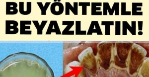 2 Dakikada Sarı Dişleri Bu Yöntemle Beyazlatın ve Ağız Kokusunu Yok Edin