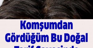 Saçlarda Oluşan Kepeğe Doğal Çözüm