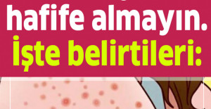 Gluten Hassasiyetini Hafife Almayın İşte Belirtileri