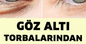Göz Altı Torbalarından ve Siyah Halkalardan Tamamen Kurtulun