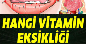 Hangi vitamin eksikliği hangi belirtileri verir?