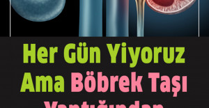 Her Gün Yiyoruz Ama Böbrek Taşı Yaptığından Kimsenin Haberi Yok