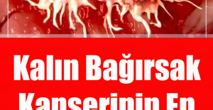Kalın Bağırsak Kanserinin En Büyük Belirtisi Bu