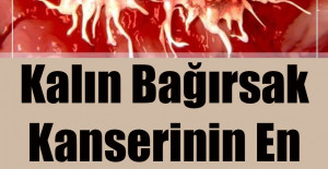 Kalın Bağırsak Kanserinin En Büyük Bulgusu