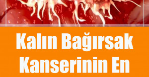 Kalın Bağırsak Kanserinin En Büyük Bulgusu