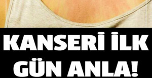 Hastalığına Ait İlk Belirtiler Nelerdir