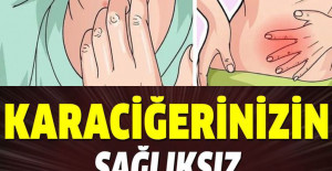Karaciğerinizin sağlıksız olduğunu gösteren 7 işaret