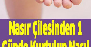 Nasır Çilesinden 1 Günde Kurtulun